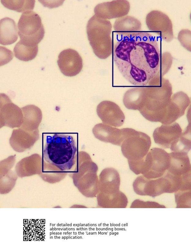 Manually Adjusted Bone Marrow Sample Image