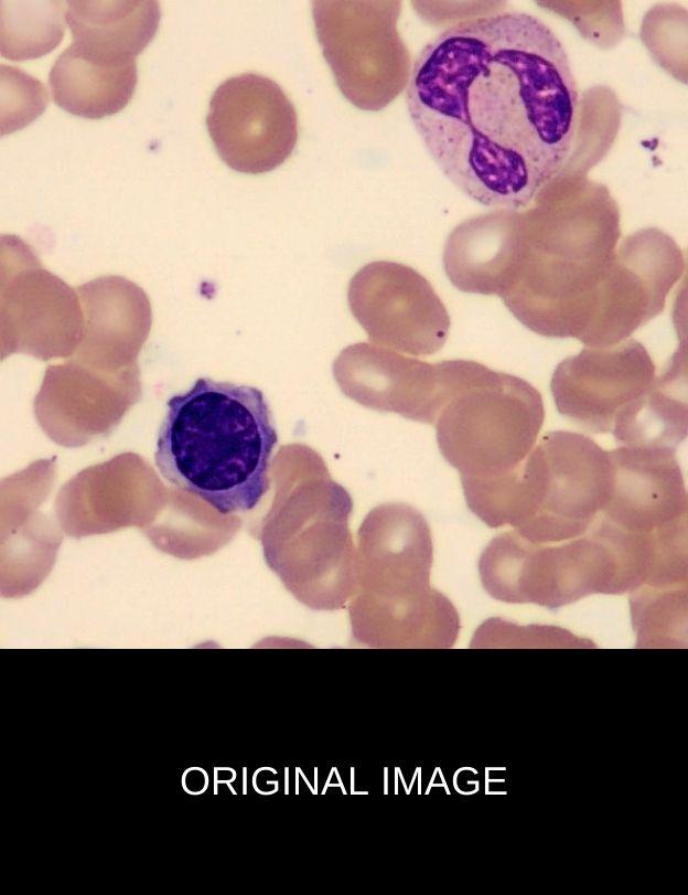 Original Bone Marrow Sample Image