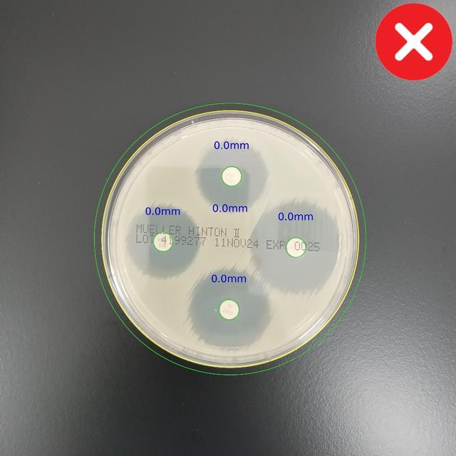 Incorrect Plate Alignment