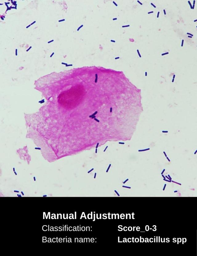 Manually Adjusted Nugent Score Image