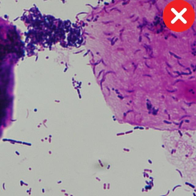 Badly Stained Specimen Image