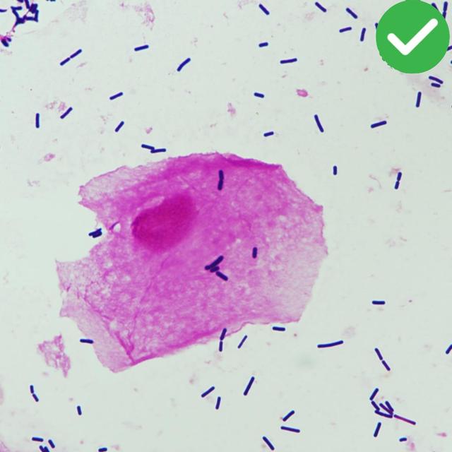 Properly Stained Specimen Image