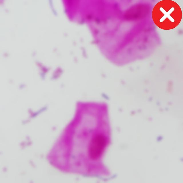 Out-of-Focus Image