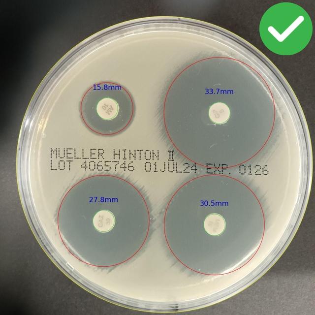 Correct Plate Alignment