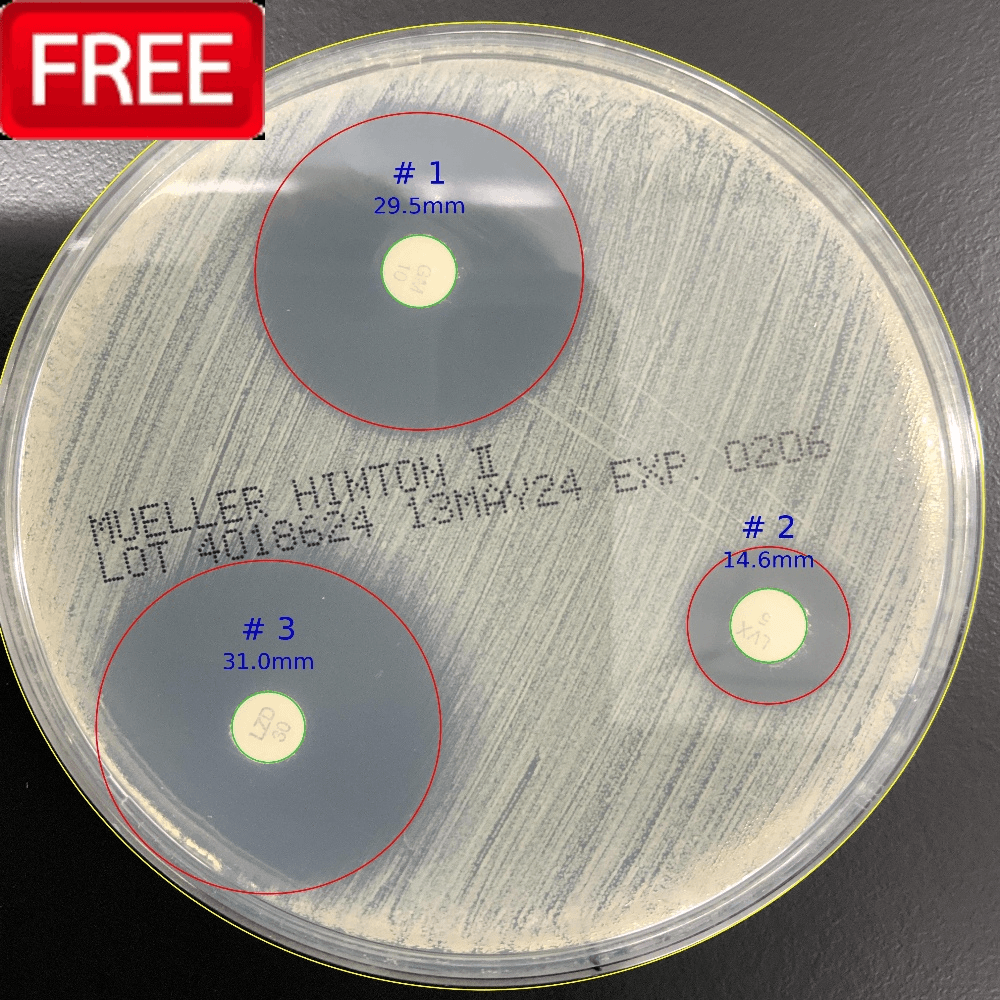 ZOI_1 - ZOI 1.0 - Zone of Inhibition - measurement ZOI_1 logo