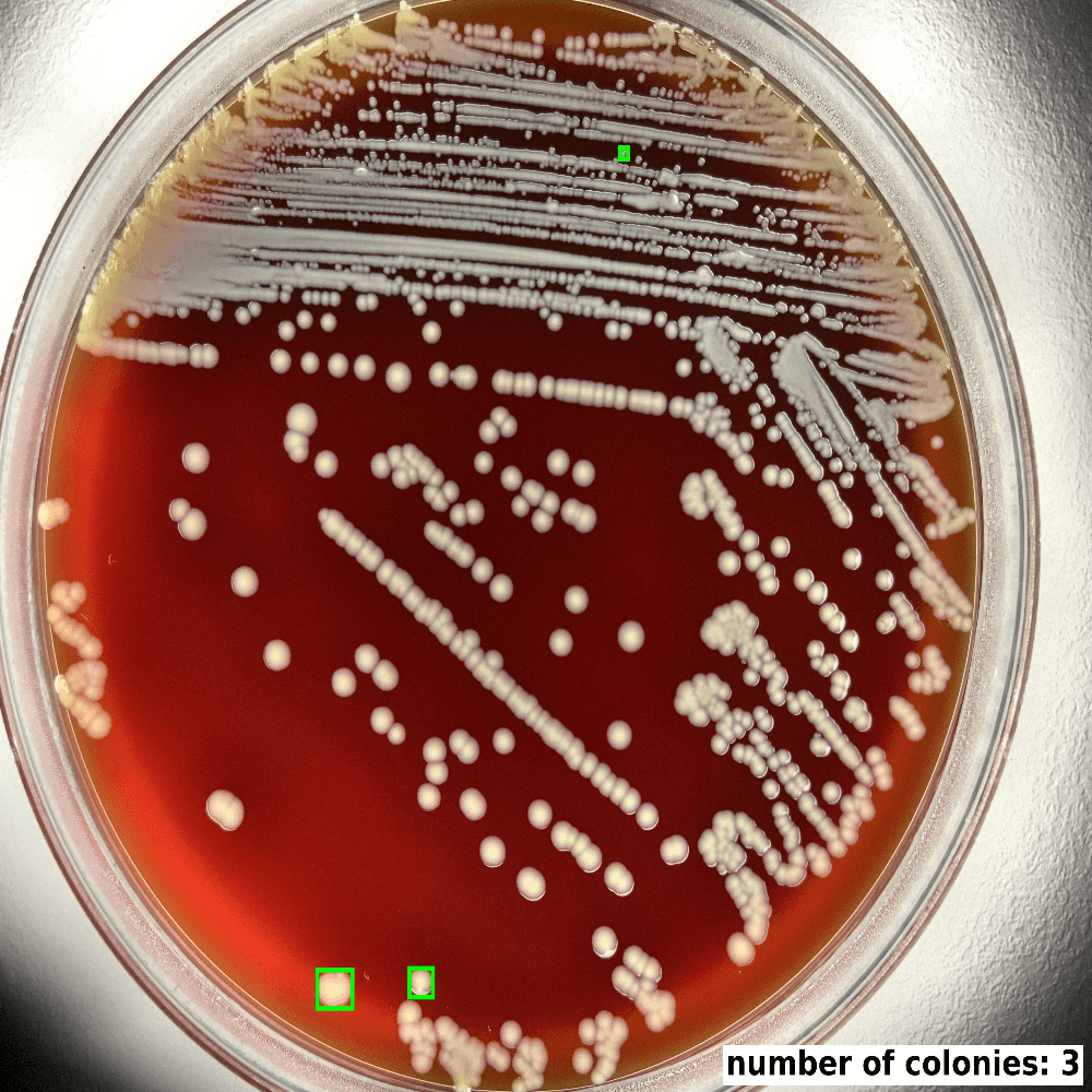 COLONY_PICK - Pick Colony 1.0 - Colony picking support COLONY_PICK logo