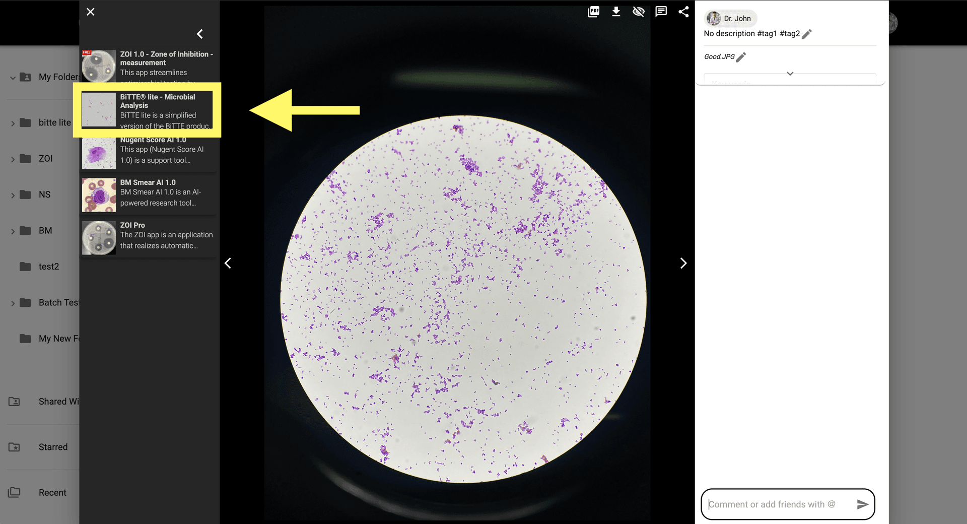 Step 2 image about Como usar BiTTE lite Analisis Microbiano tutorial Step 2: Haz clic en el ícono de BiTTE lite para abrir la configuración de la aplicación.