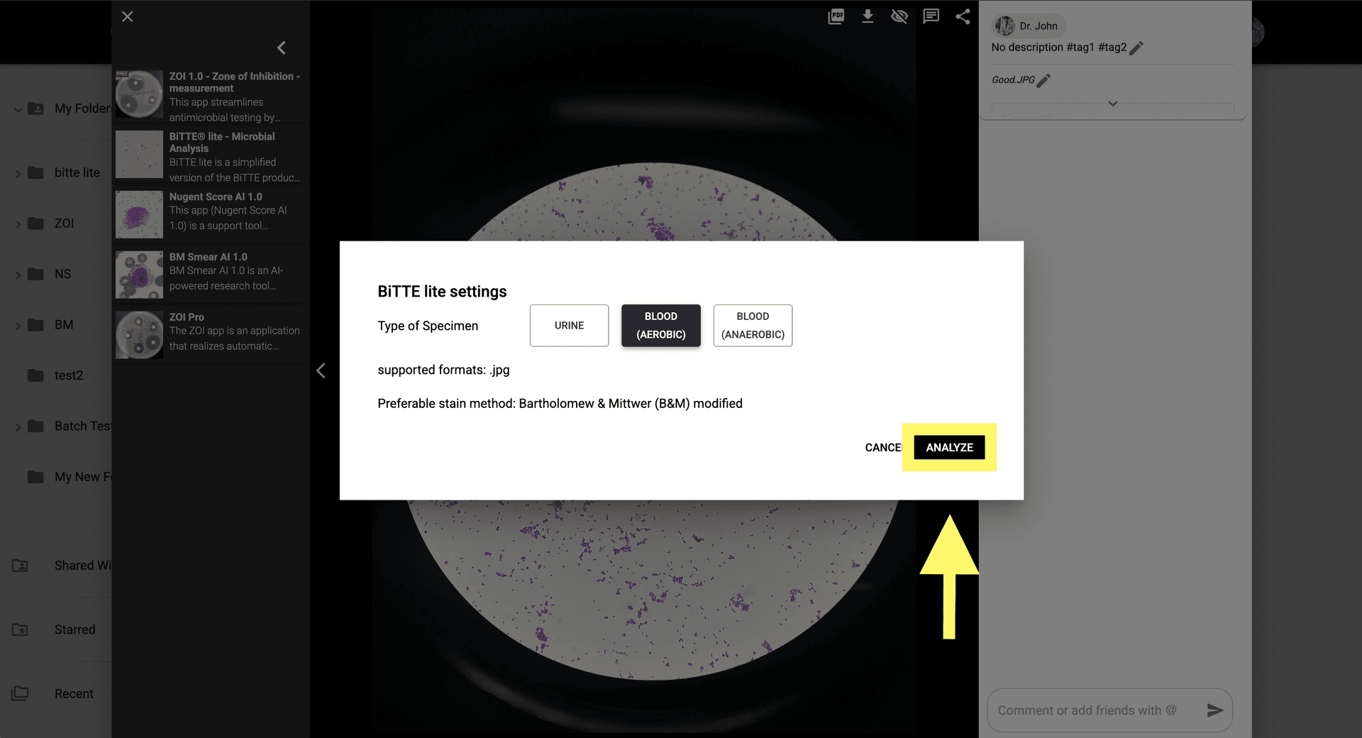 Step 4 image about Como usar BiTTE lite Analisis Microbiano tutorial Step 4: Haz clic en 'Analizar' para comenzar la detección bacteriana basada en IA y la evaluación de parámetros.