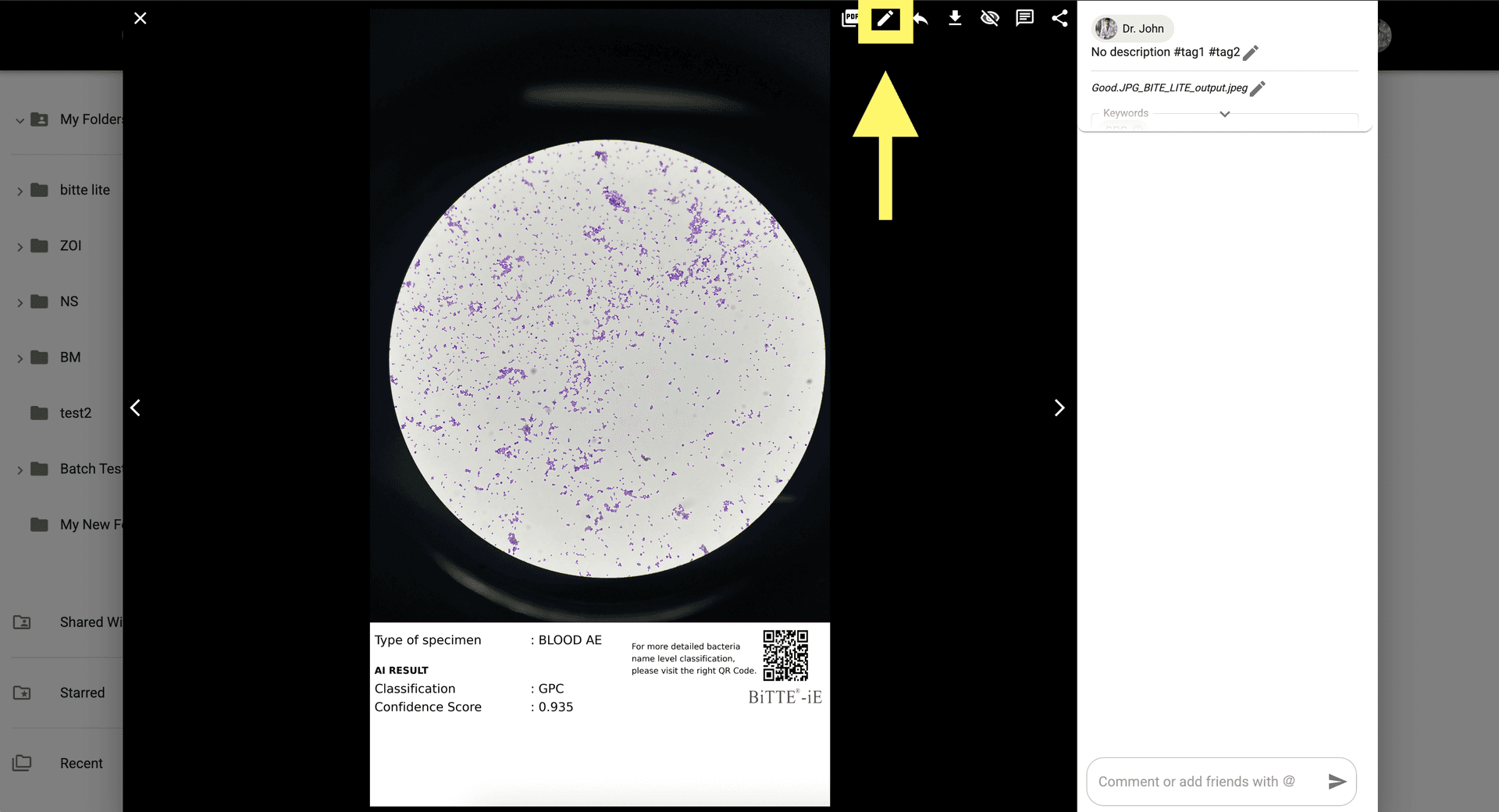 Step 6 image about Como usar BiTTE lite Analisis Microbiano tutorial Step 6: Para ajustes manuales, haz clic en 'Mostrar corrección de IA' en la esquina superior derecha.