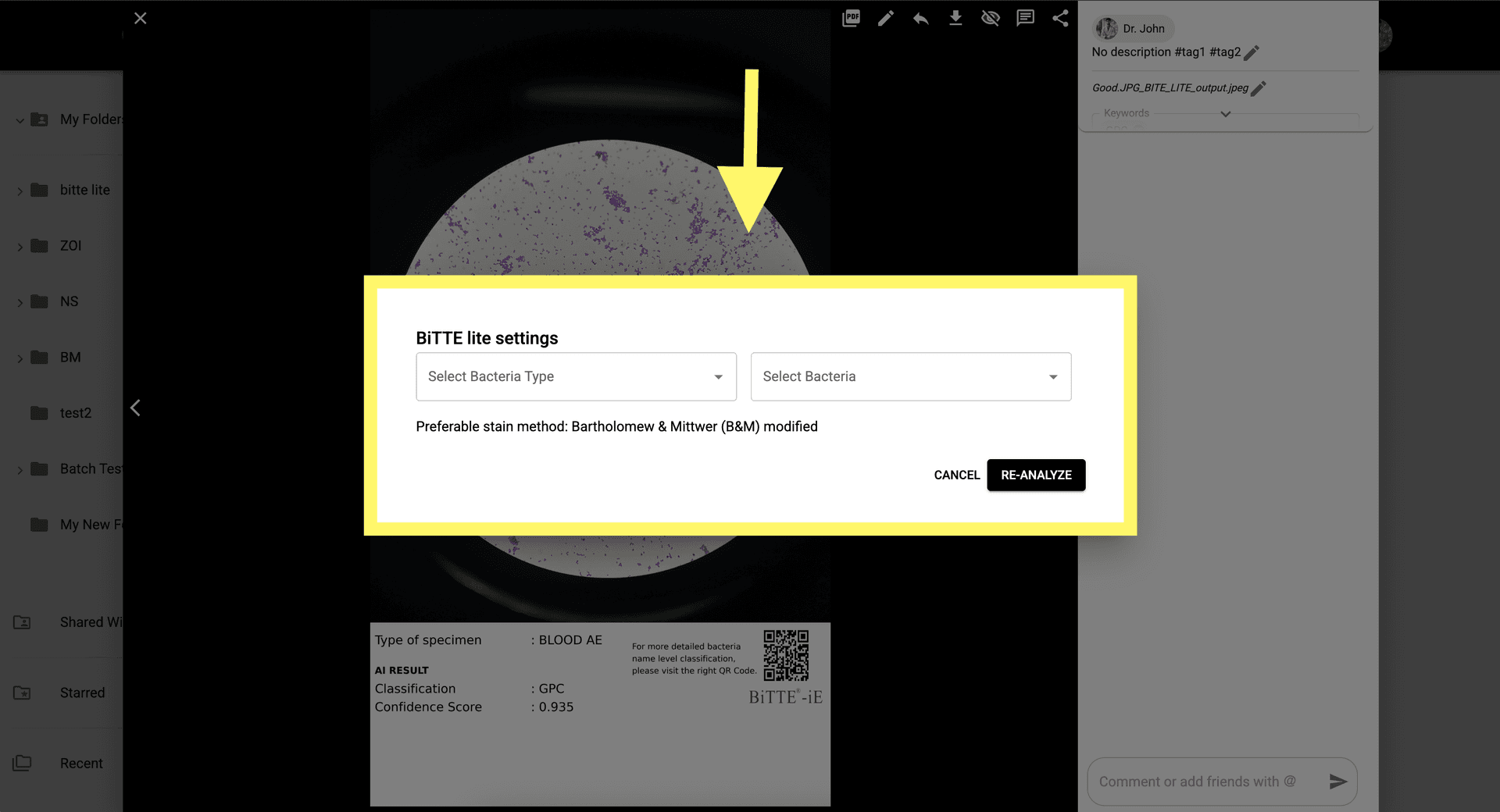 Step 7 image about Como usar BiTTE lite Analisis Microbiano tutorial Step 7: Selecciona manualmente el Tipo de Bacteria y el Nombre de la Bacteria si es necesario antes de re-analizar.