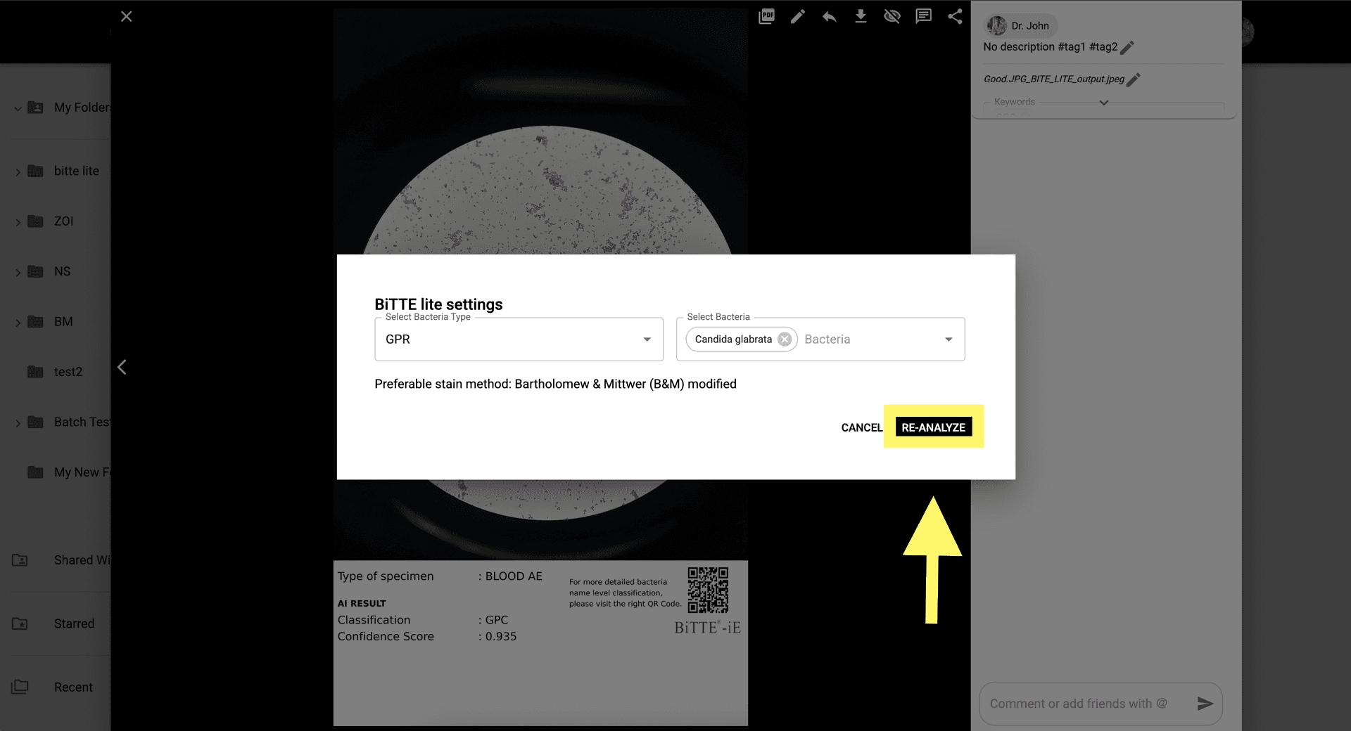 Step 8 image about Como usar BiTTE lite Analisis Microbiano tutorial Step 8: Haz clic en 'Re-analizar' para confirmar cualquier cambio manual y actualizar los resultados.