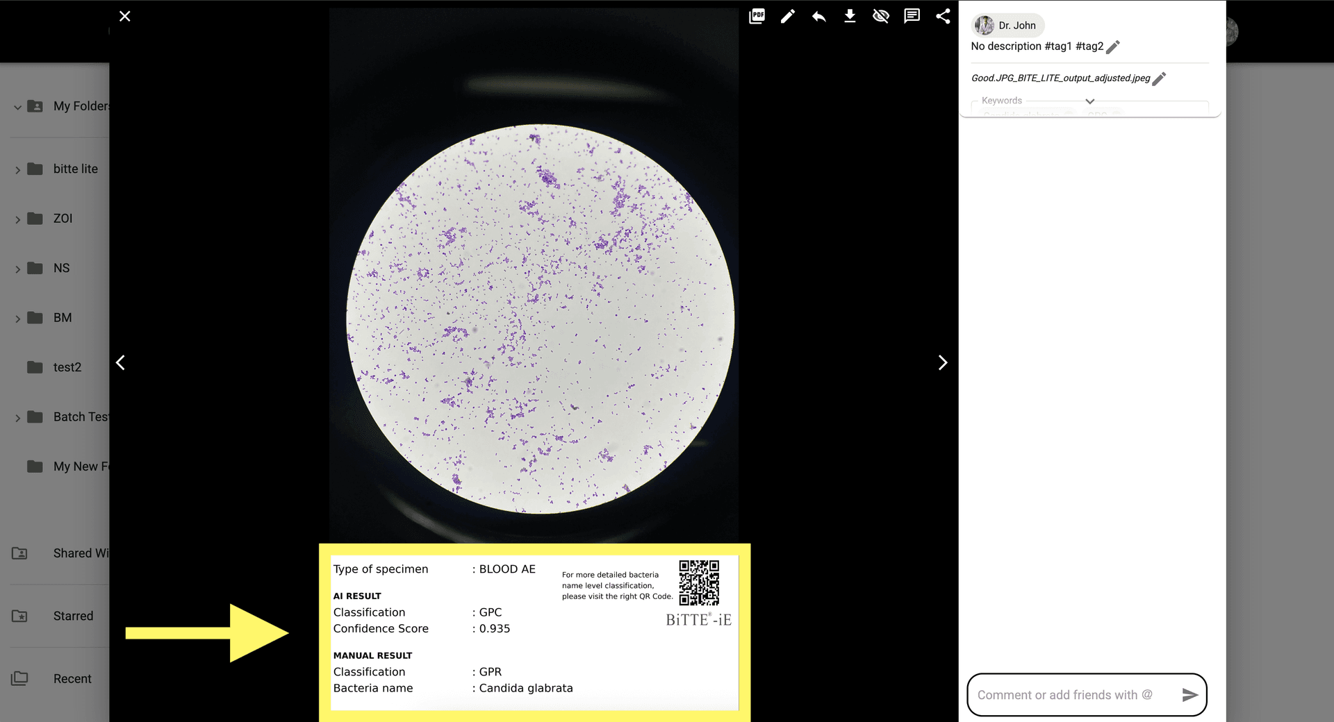 Step 9 image about Como usar BiTTE lite Analisis Microbiano tutorial Step 9: Verás tanto el 'RESULTADO DE IA' como el 'RESULTADO MANUAL' una vez re-analizado, disponible en la galeria o desde la notificación.