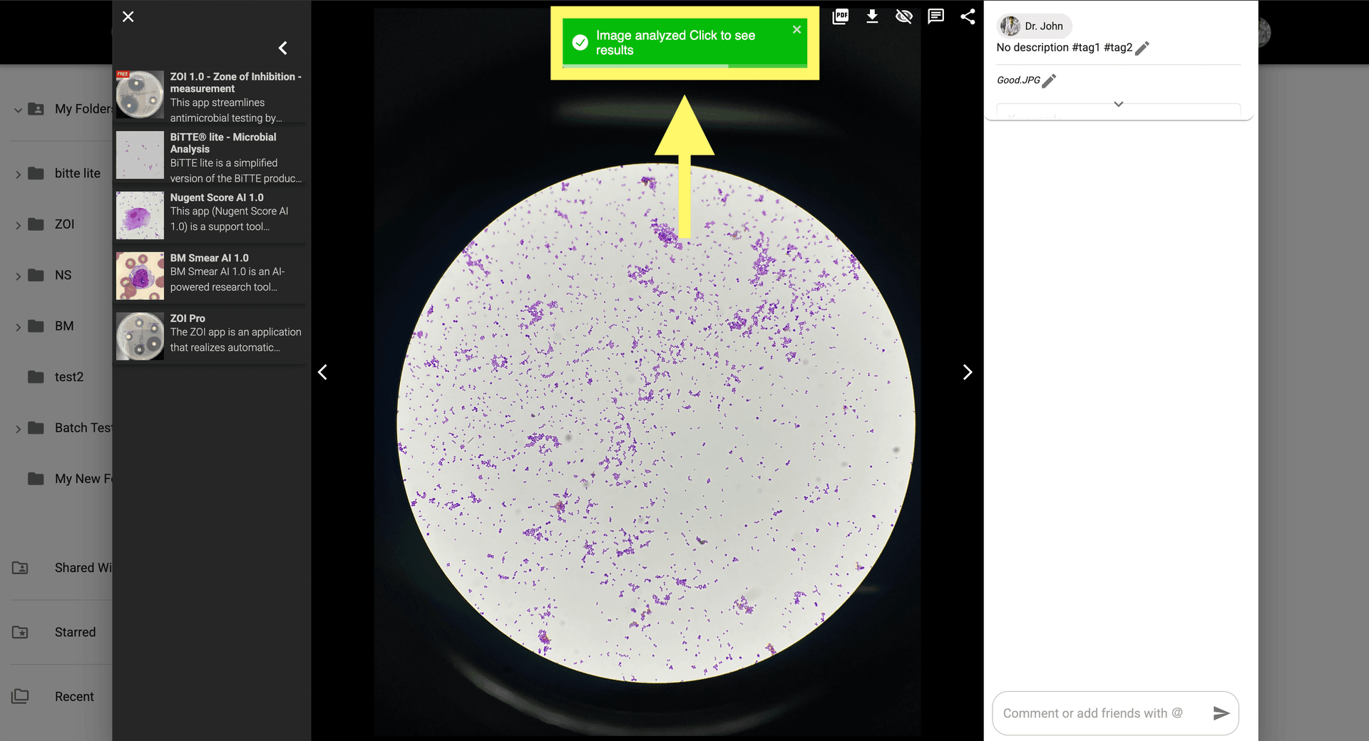 Step 5 image about Como usar BiTTE lite Analisis Microbiano tutorial Step 5: Revisa los resultados del análisis en el modal de imagen o abre la imagen generada desde la galeria.