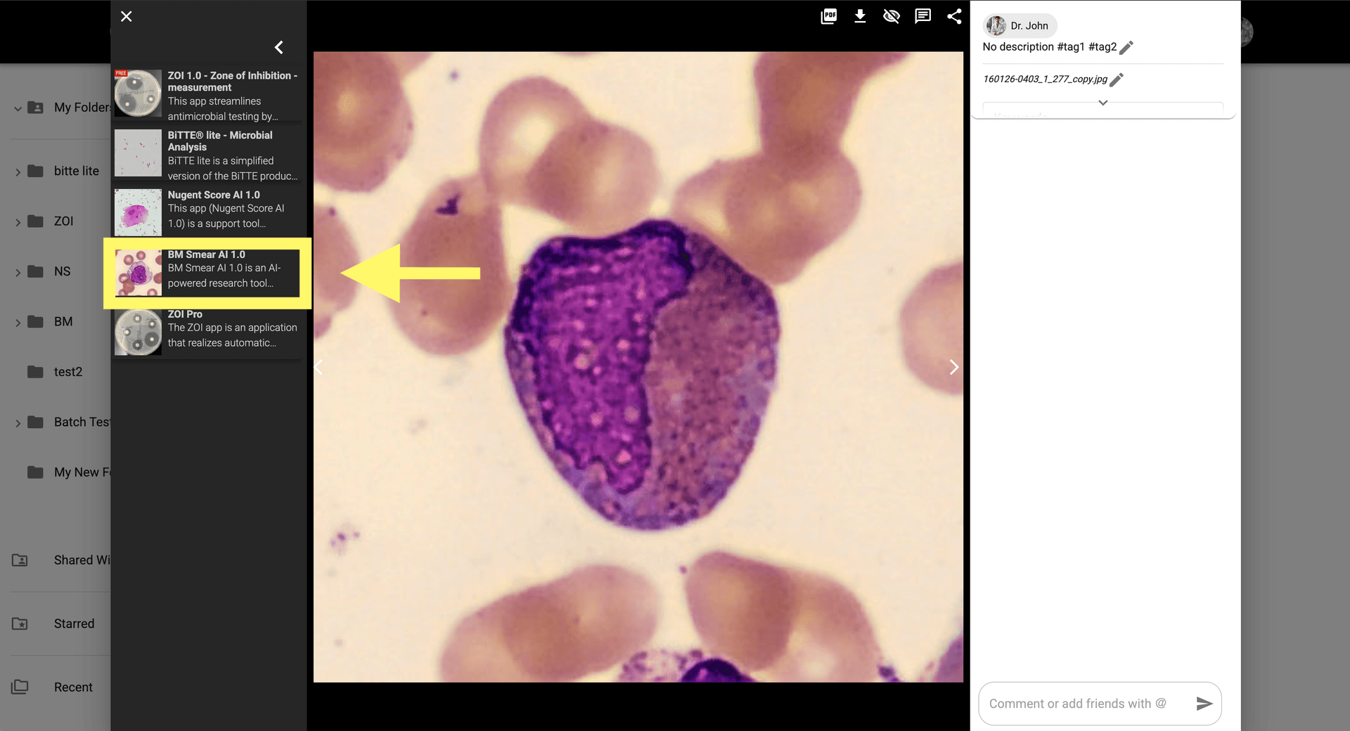 Step 2 image about How to use BM Smear AI 1.0 tutorial Step 2: Click on the BM Smear Icon to open the application settings.