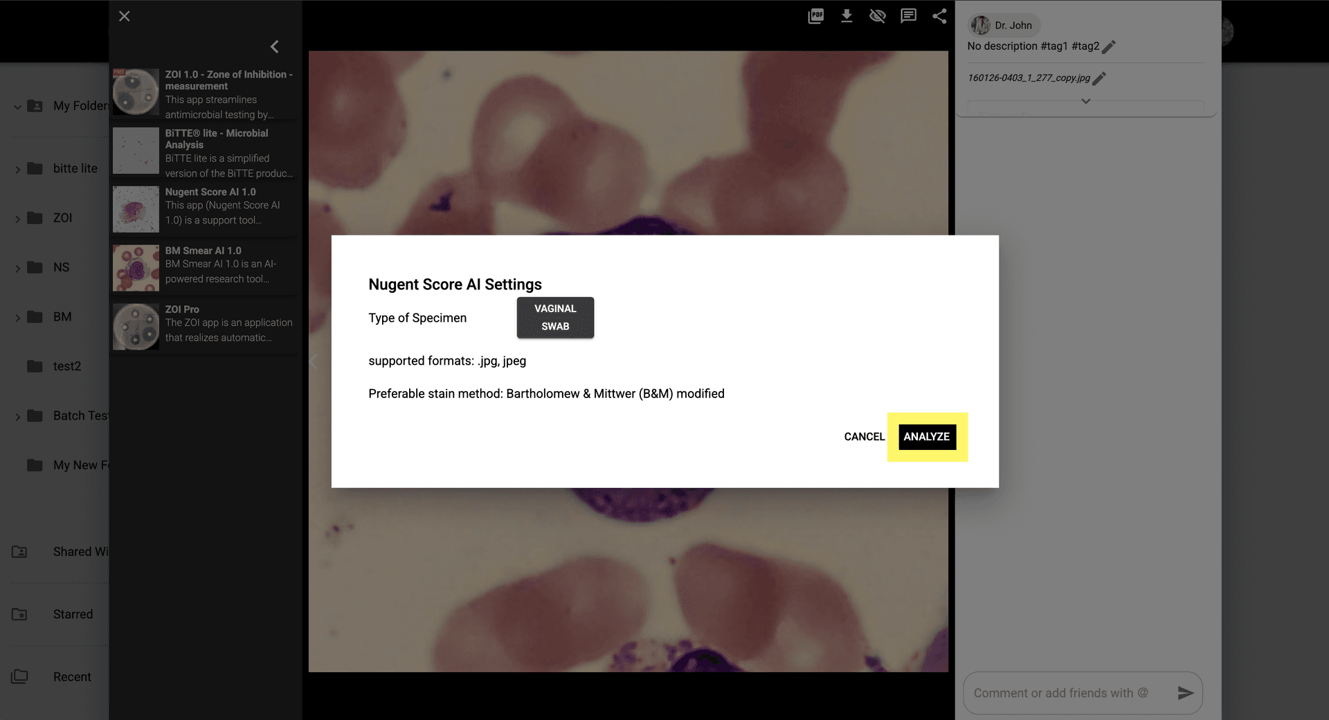 Step 4 image about How to use BM Smear AI 1.0 tutorial Step 4: Click 'Analyze' to process and detect relevant cell types.