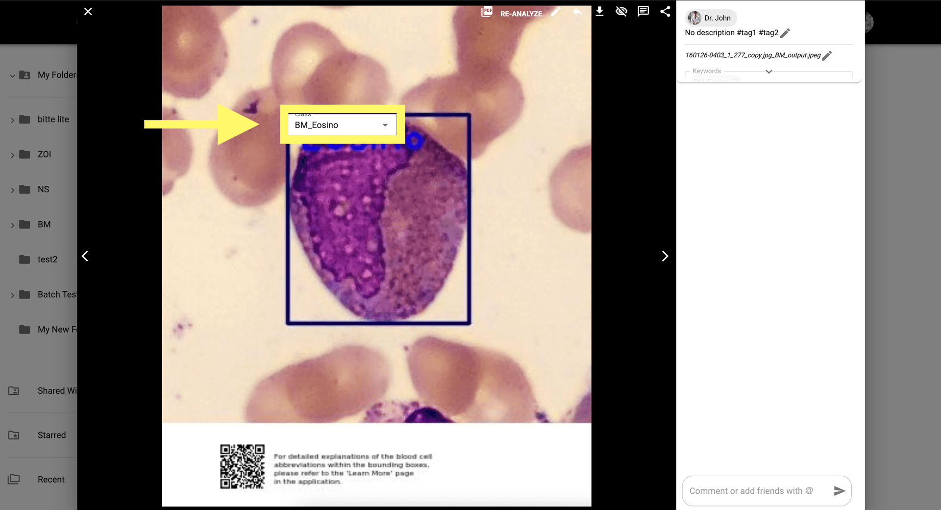 Step 7 image about How to use BM Smear AI 1.0 tutorial Step 7: Enable manual editing to re-classify cells if the AI result requires correction.