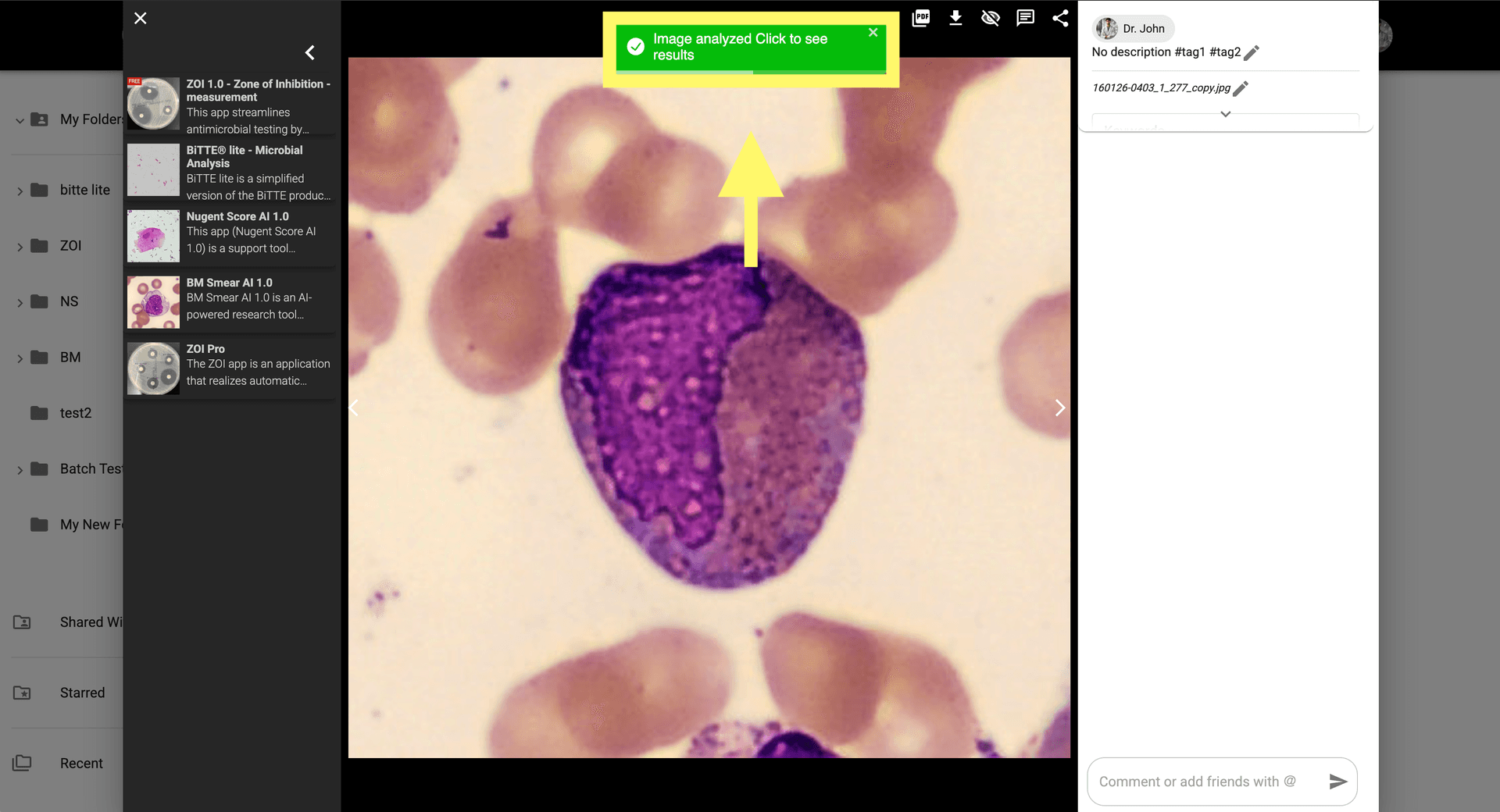 Step 5 image about How to use BM Smear AI 1.0 tutorial Step 5: Check the results by clicking the notification or viewing the image in the gallery.