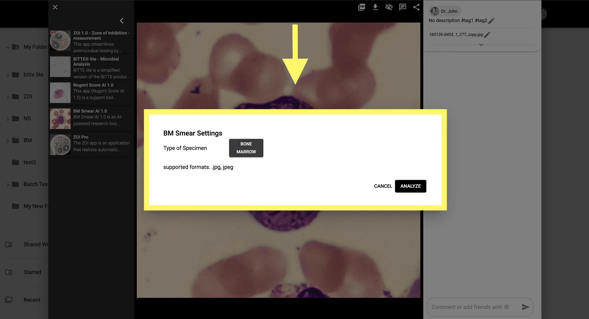 Step 3 image about How to use BM Smear AI 1.0 tutorial Step 3: Set the parameters for AI-based analysis of the smear, in this case is BONE MARROW.