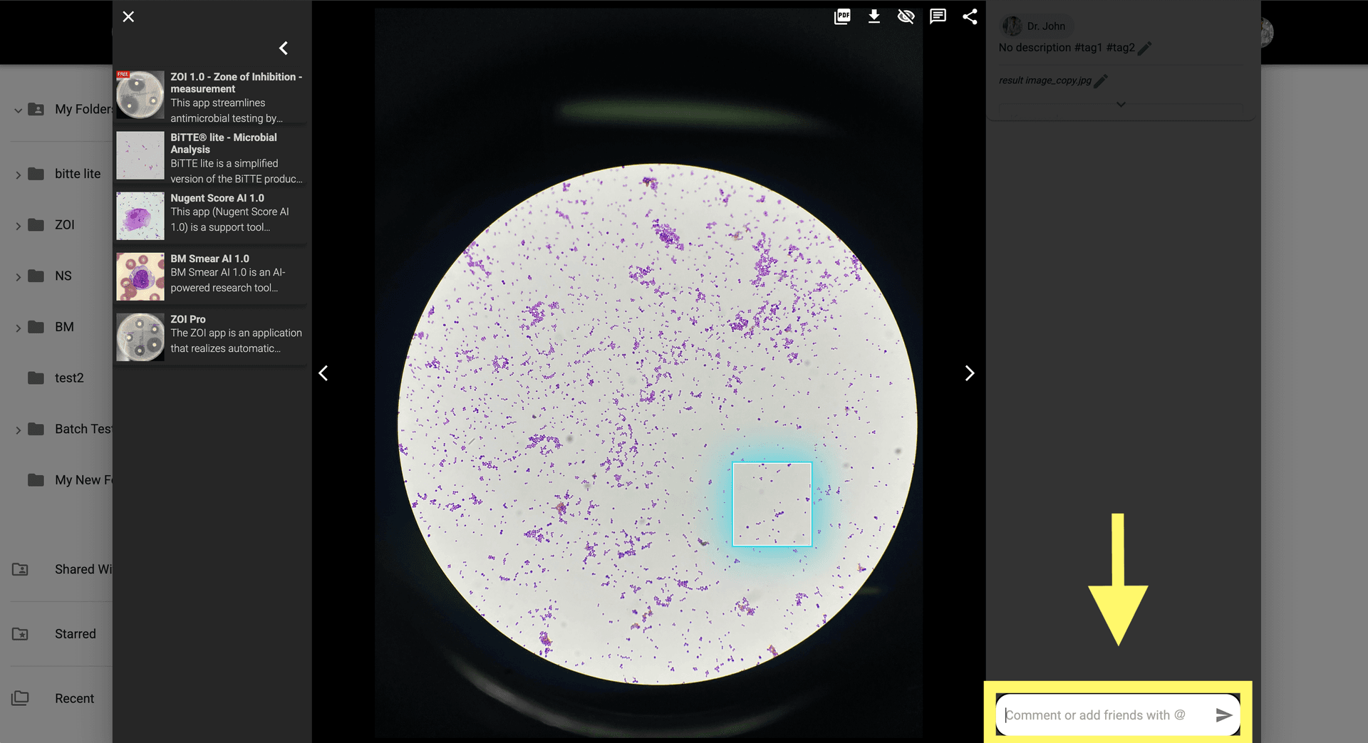 Step 3 image about Crear una Anotacion tutorial Step 3: Agrega un comentario a la anotación escribiendo en el cuadro de entrada de comentarios y haz clic en 'Enviar'.