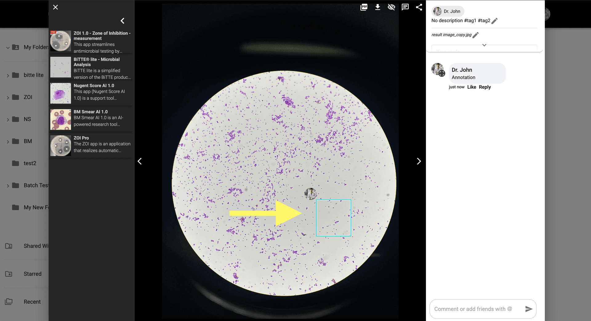 Step 4 image about Crear una Anotacion tutorial Step 4: Espera a que se envíe el comentario y lo verás en la imagen.