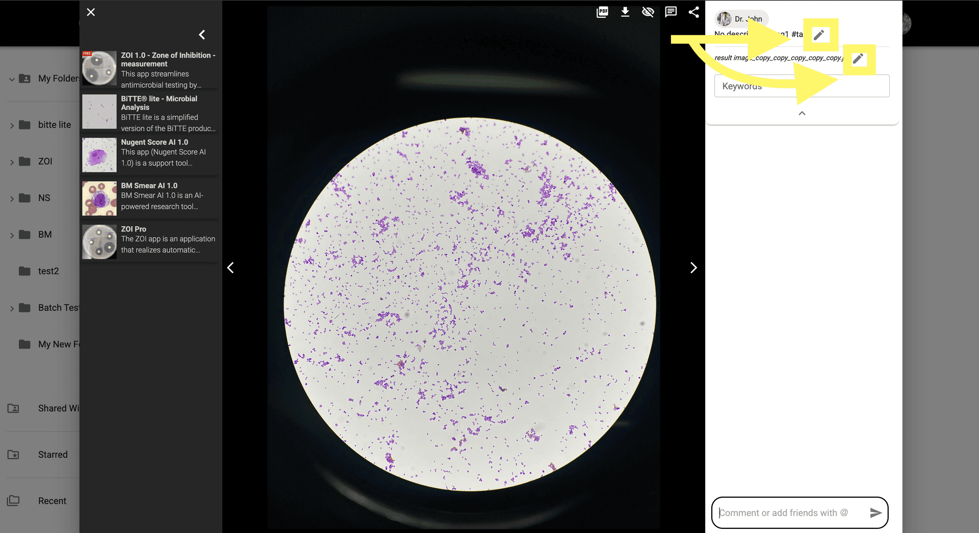 Step 3 image about Thay đổi thông tin hình ảnh tutorial Step 3: Nhấp vào nút 'Chỉnh sửa' để thay đổi chi tiết hình ảnh.