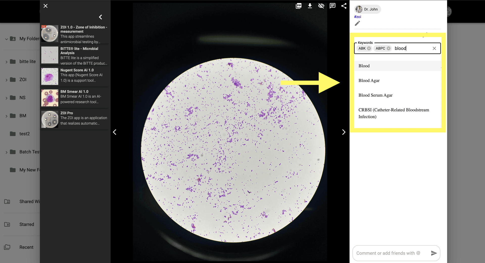 Step 5 image about Thay đổi thông tin hình ảnh tutorial Step 5: Thêm từ khóa vào hình ảnh bằng cách nhấp vào ô nhập 'Từ khóa'.