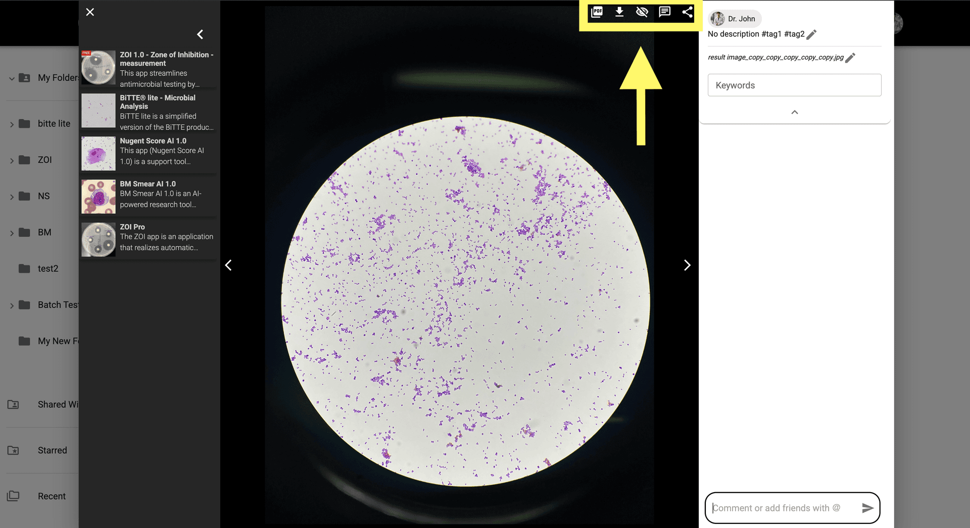 Step 3 image about Introduccion al modal de imagen tutorial Step 3: Desde la barra de herramientas puedes descargar la imagen como PDF o imagen simple, ocultar o mostrar los comentarios y compartir la imagen con tus colegas.