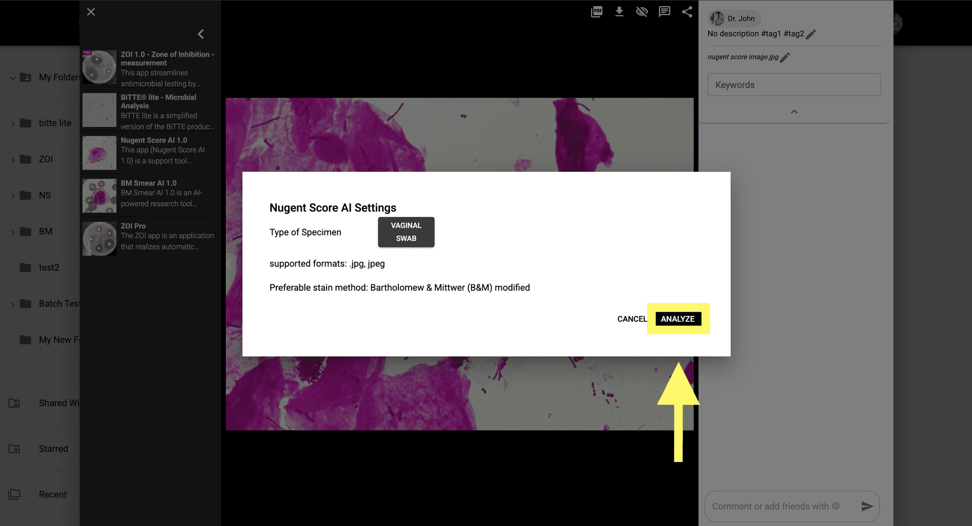 Step 4 image about How to use Nugent Score AI 1.0 tutorial Step 4: Click 'Analyze' to run the AI-based scoring on the microscopy image.