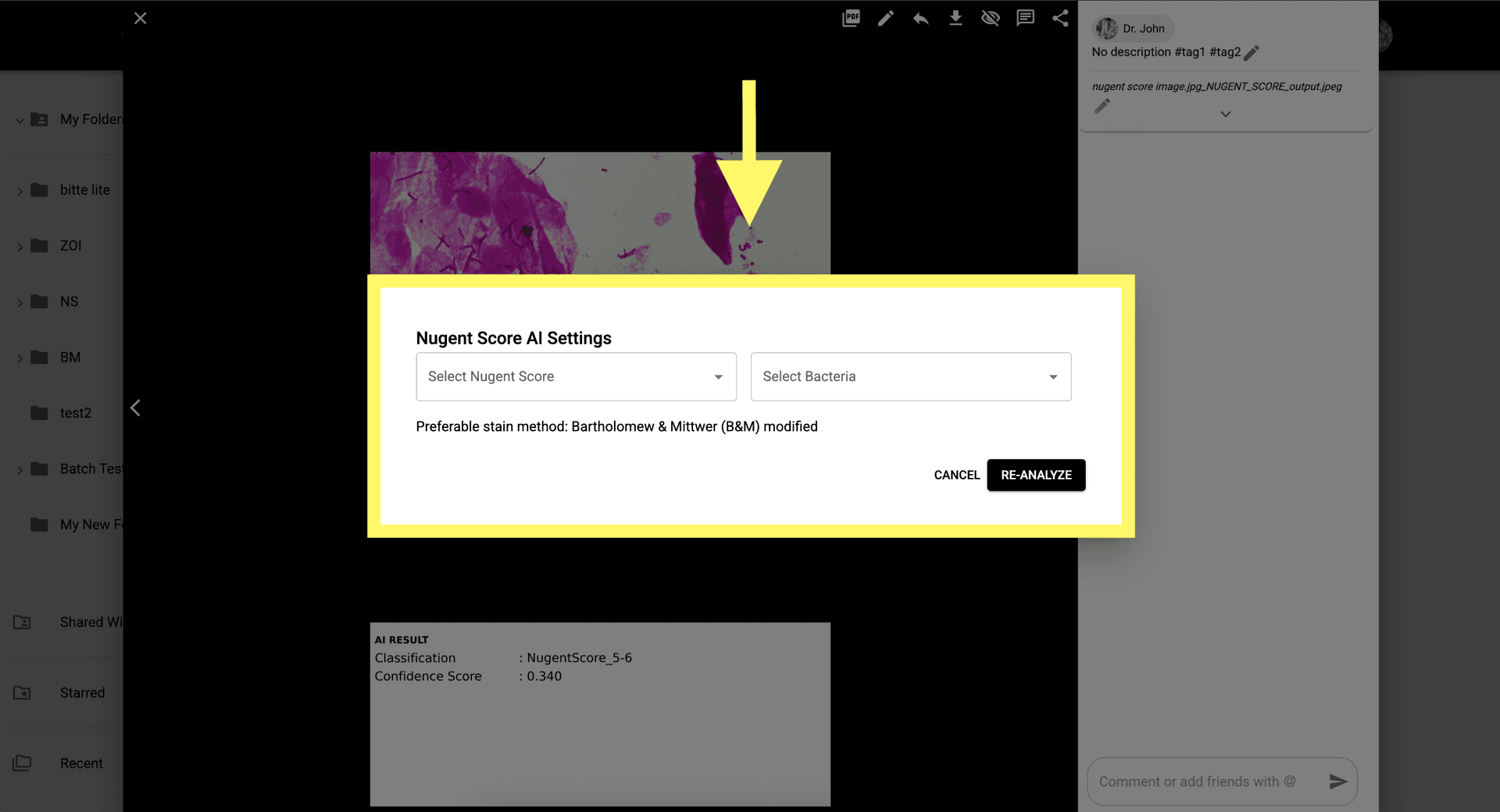 Step 7 image about How to use Nugent Score AI 1.0 tutorial Step 7: Enable manual entry of the Nugent Score and Bacteria Name if you wish to override the results.