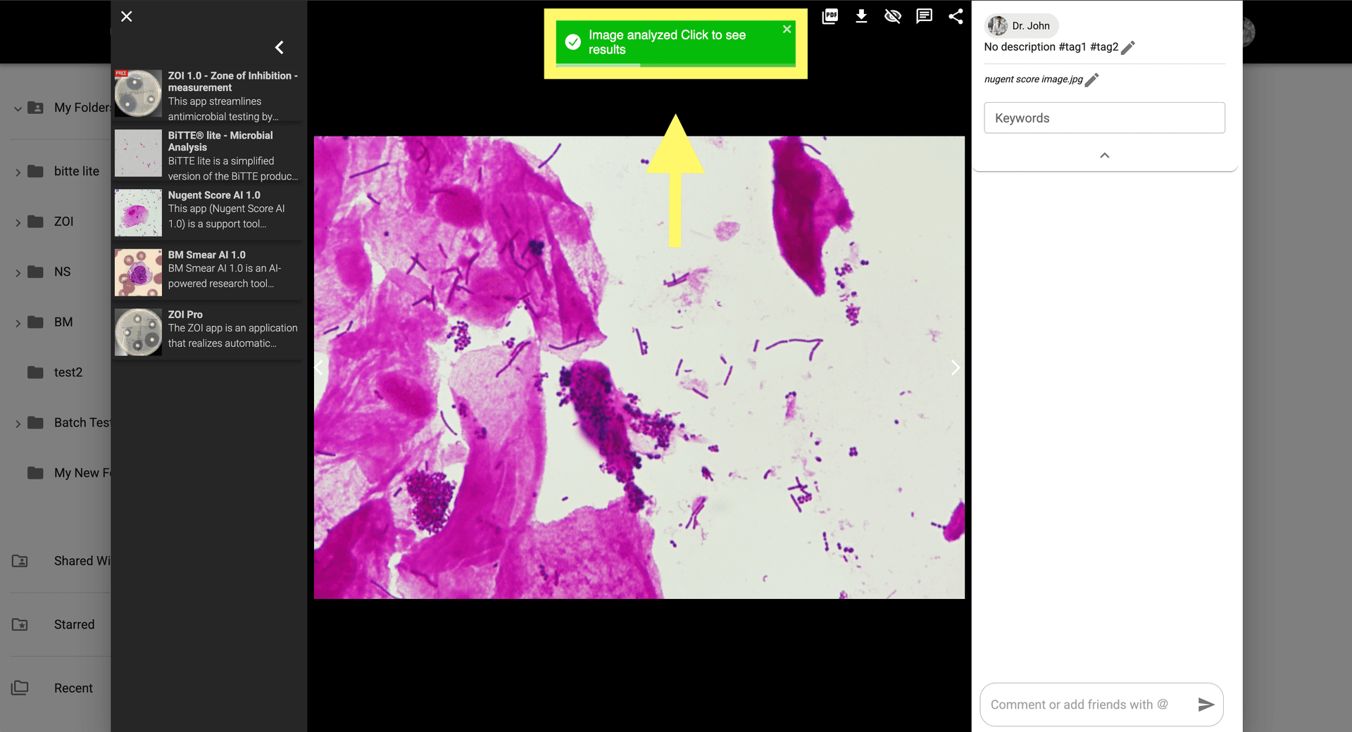 Step 5 image about How to use Nugent Score AI 1.0 tutorial Step 5: View the analysis results by clicking the notification or opening the generated image in the gallery.