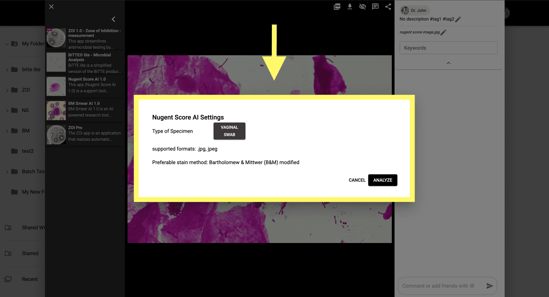 Step 3 image about How to use Nugent Score AI 1.0 tutorial Step 3: Configure the settings to classify bacterial populations under the Nugent scoring system.