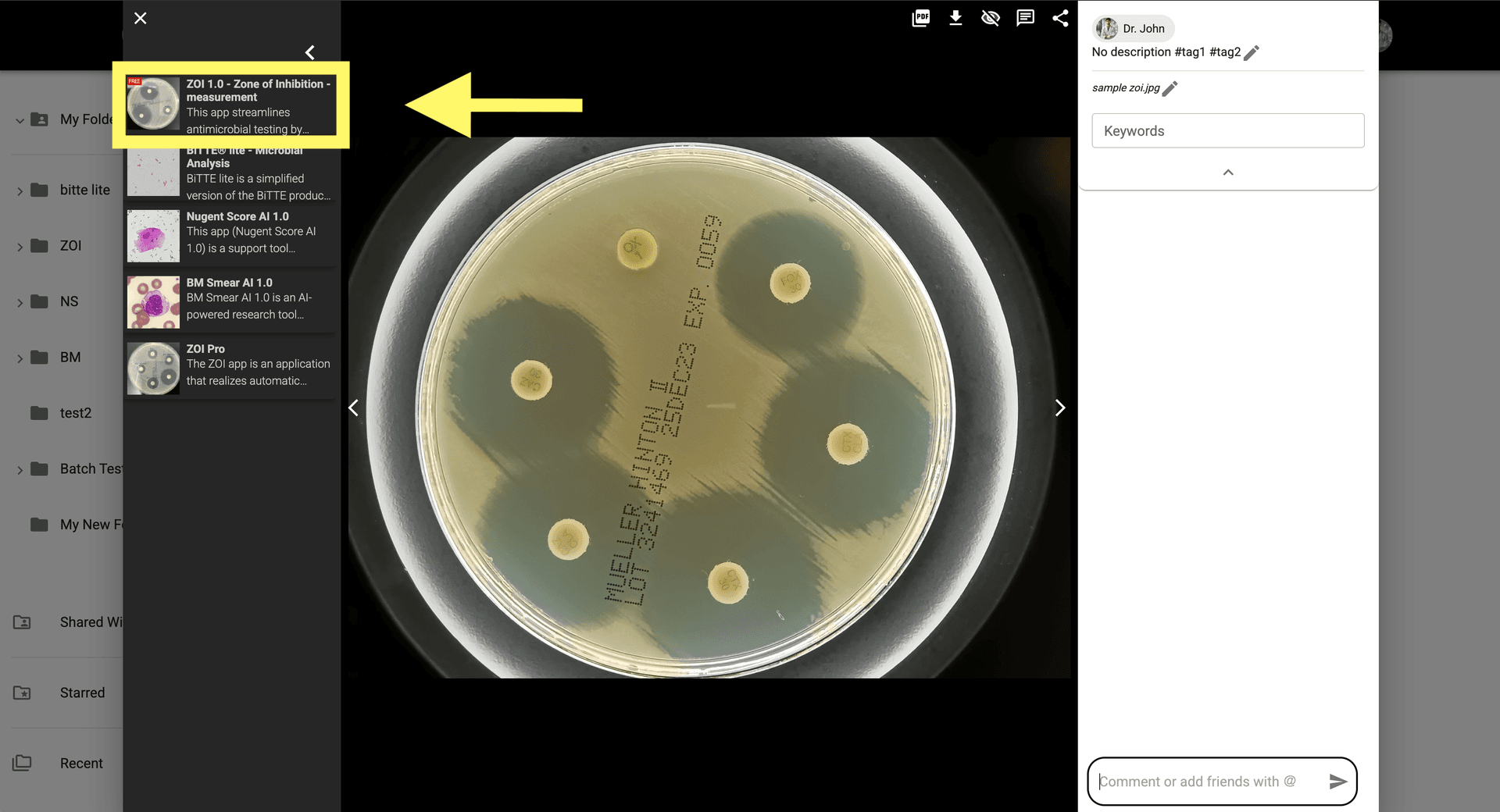 Step 2 image about Comment utiliser ZOI 1.0 Zone de mesure d'inhibition tutorial Step 2: Cliquez sur l'icône ZOI 1.0 pour ouvrir les paramètres de l'application.