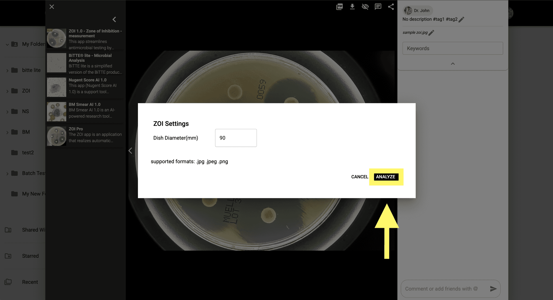 Step 4 image about Comment utiliser ZOI 1.0 Zone de mesure d'inhibition tutorial Step 4: Cliquez sur 'Analyser' pour lancer l'analyse et mesurer le ZOI par rapport à différents disques antibiotiques.