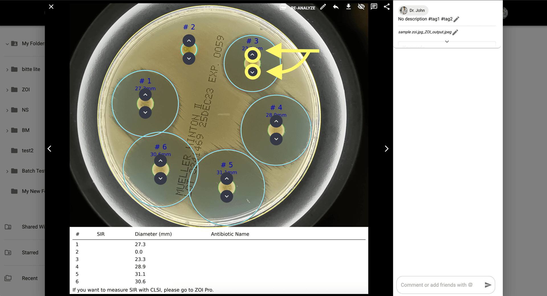 Step 7 image about Comment utiliser ZOI 1.0 Zone de mesure d'inhibition tutorial Step 7: Activez les ajustements manuels pour affiner les zones ZOI si nécessaire.