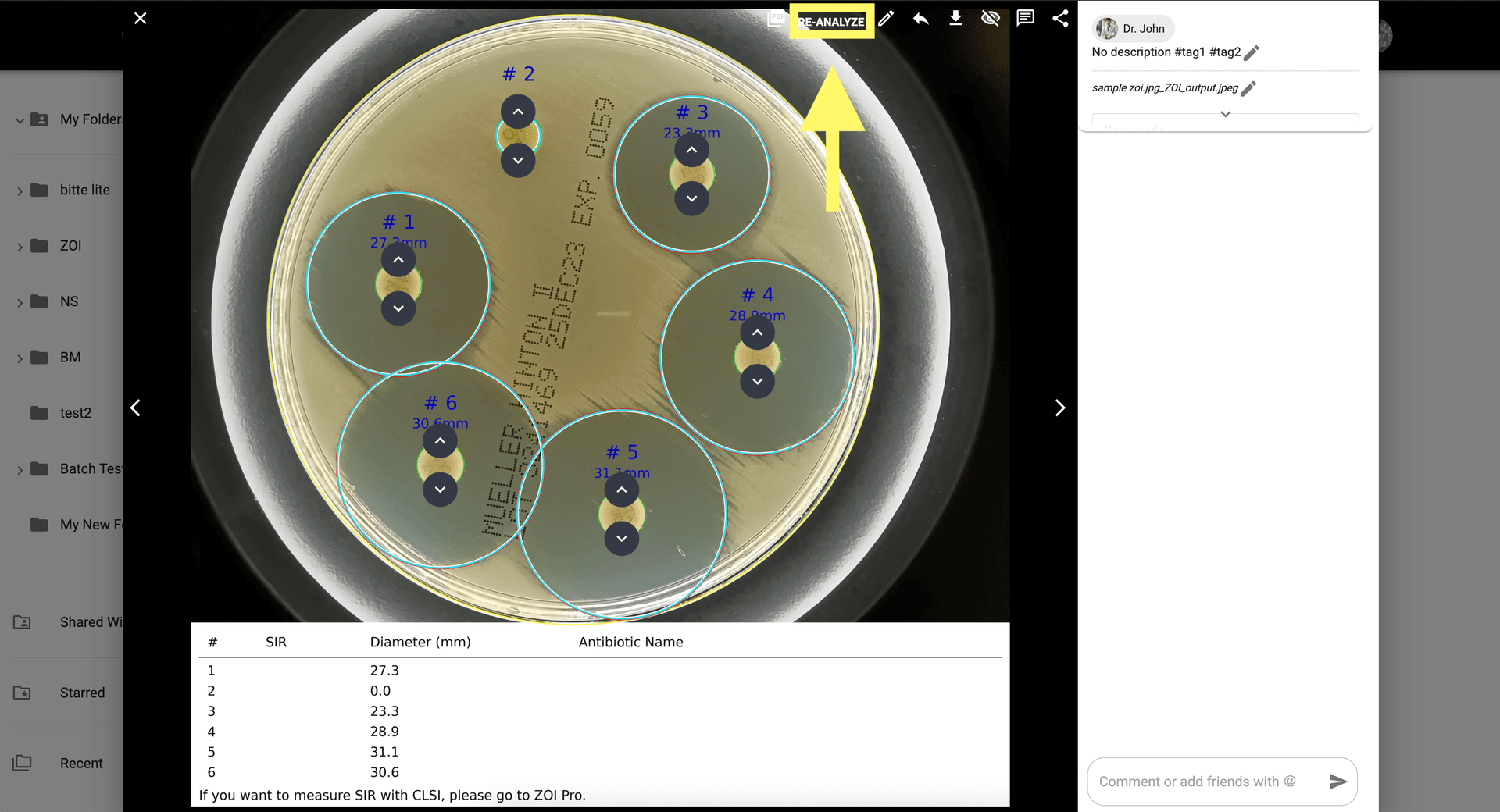 Step 8 image about Comment utiliser ZOI 1.0 Zone de mesure d'inhibition tutorial Step 8: Une fois terminé, cliquez sur 'Relancer l’analyse' pour enregistrer vos modifications manuelles et finaliser la mesure.