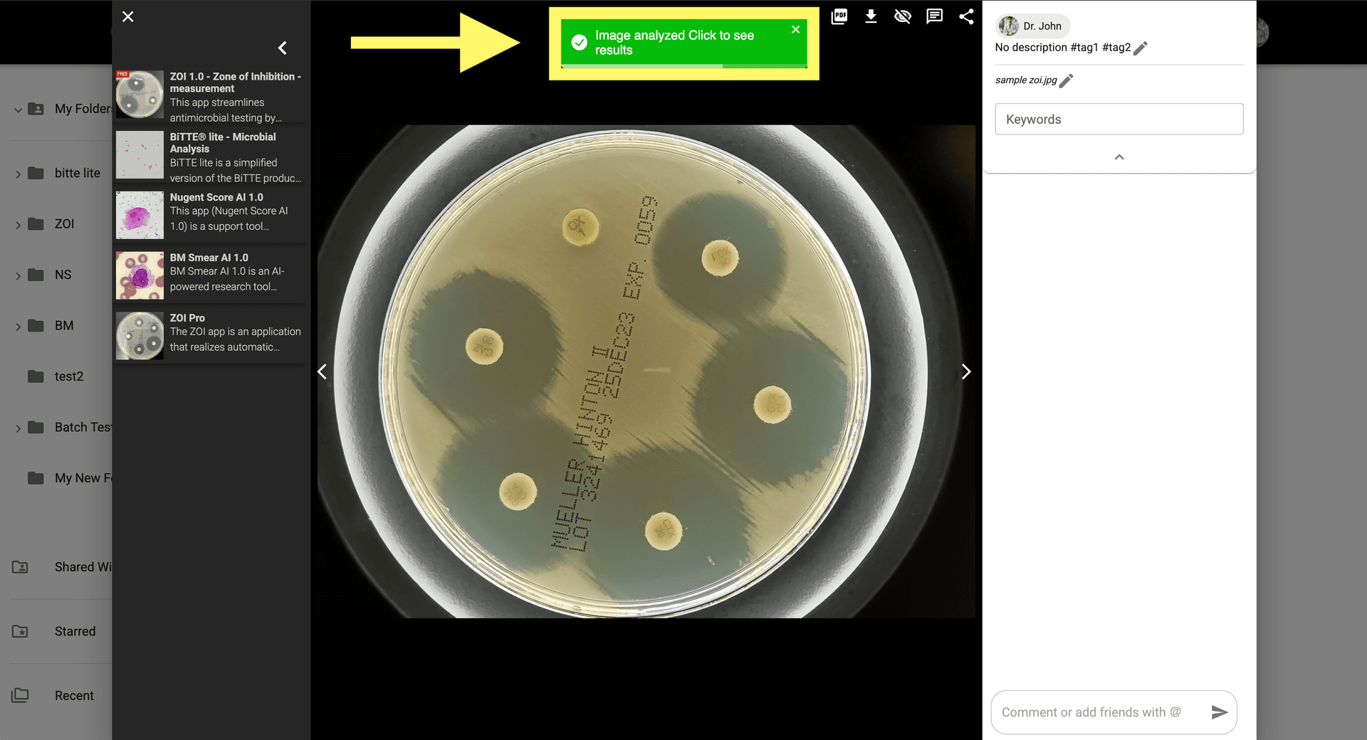 Step 5 image about Comment utiliser ZOI 1.0 Zone de mesure d'inhibition tutorial Step 5: Consultez les résultats dans le modal d'image en cliquant sur la notification ou en ouvrant l'image générée depuis la galerie.