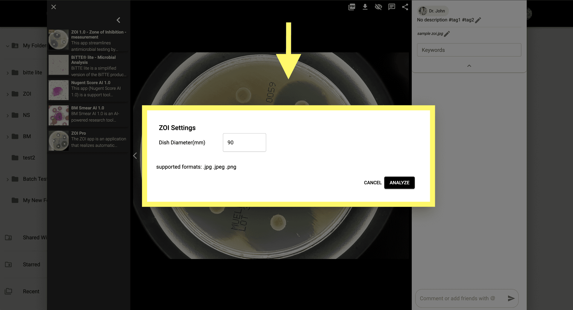 Step 3 image about Comment utiliser ZOI 1.0 Zone de mesure d'inhibition tutorial Step 3: Configurez les paramètres d'analyse pour mesurer les zones d'inhibition et détecter l'inhibition de la croissance bactérienne.