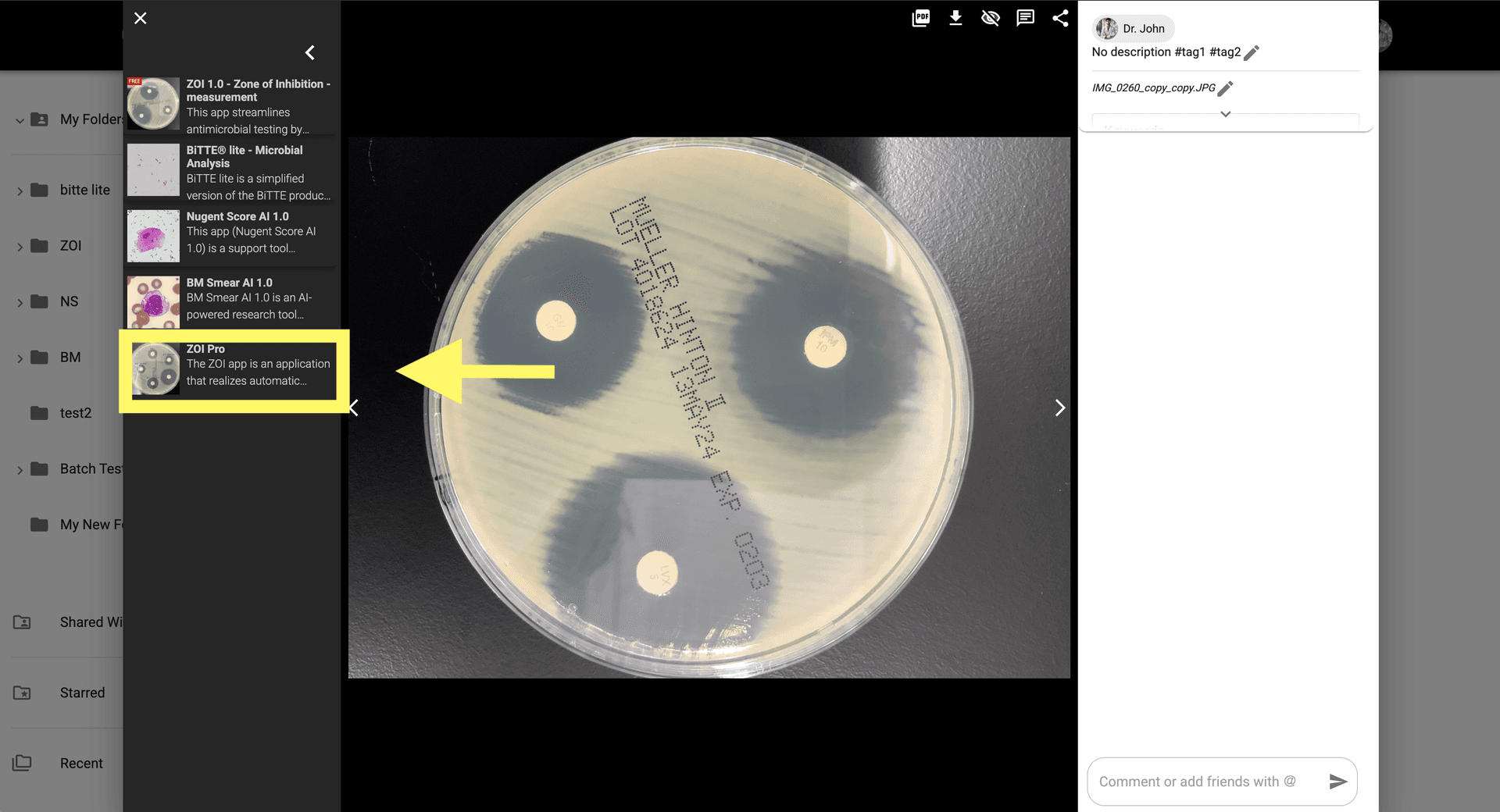 Step 2 image about Cara menggunakan ZOI Pro tutorial Step 2: Klik pada Ikon ZOI Pro untuk membuka pengaturan aplikasi untuk analisis lanjutan.