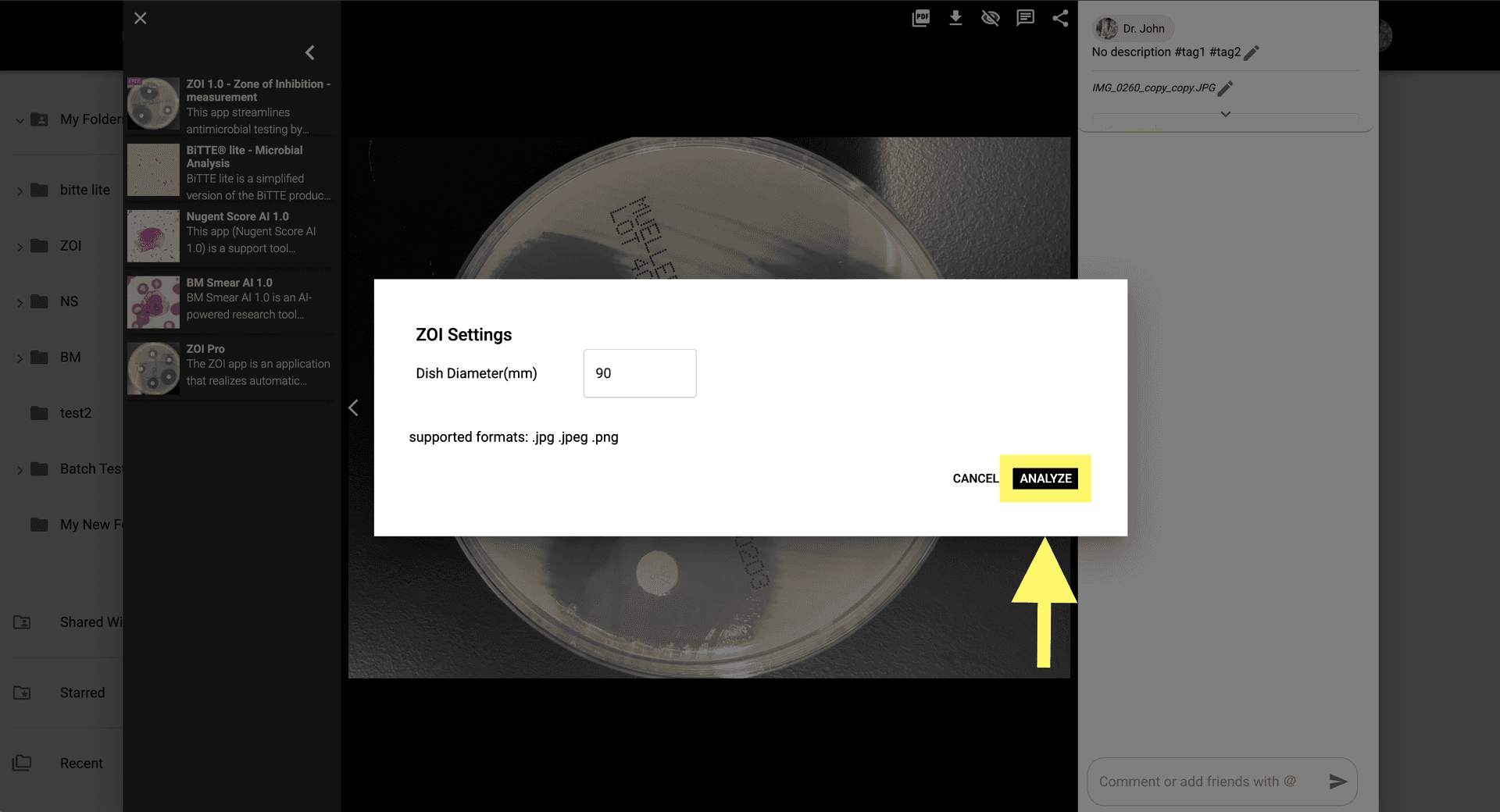 Step 4 image about Cara menggunakan ZOI Pro tutorial Step 4: Klik 'Analisis' untuk memulai proses AI lanjutan, yang akan mengukur ZOI.