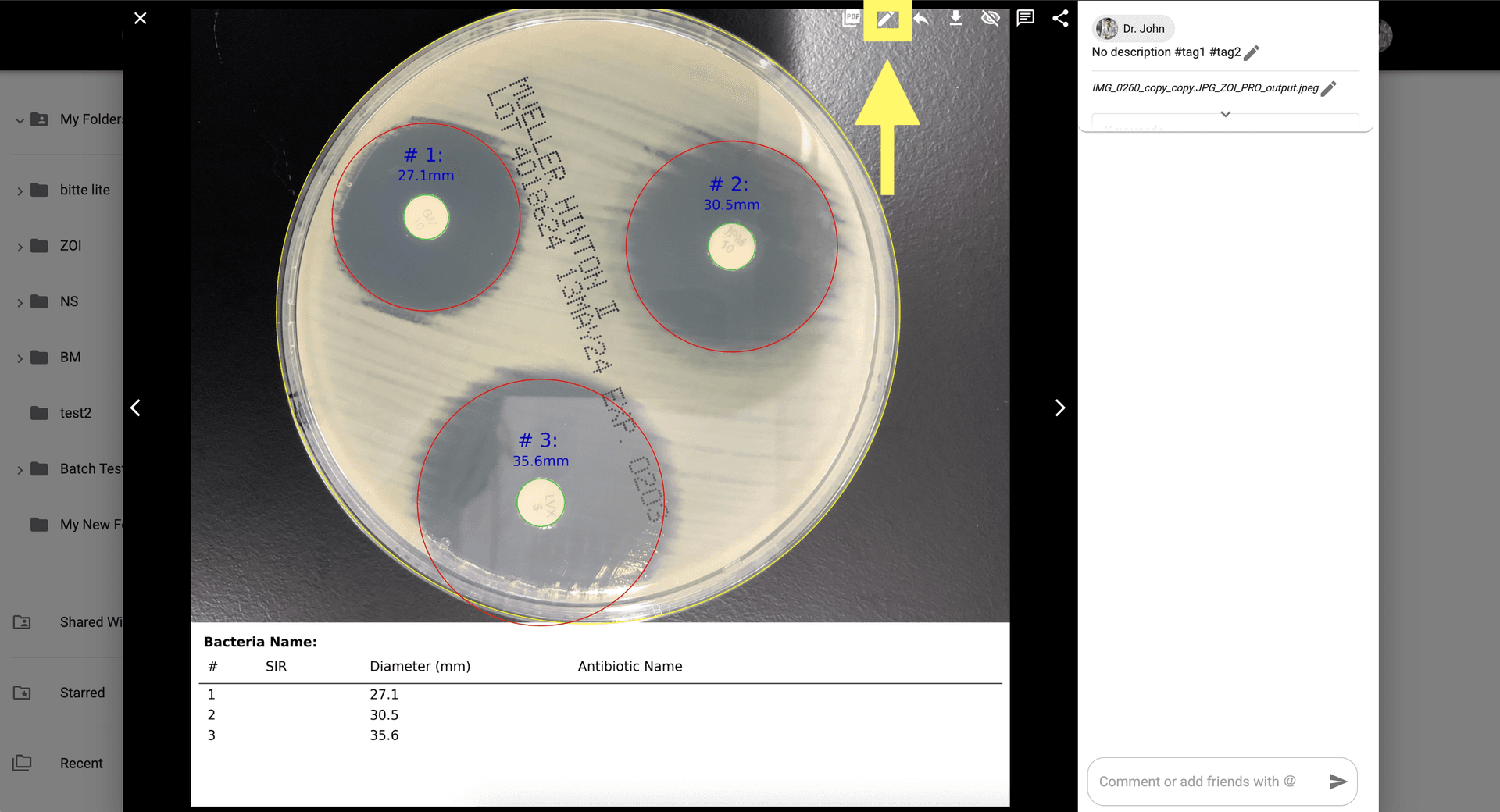Step 6 image about Cara menggunakan ZOI Pro tutorial Step 6: Untuk penyesuaian manual, klik 'Tampilkan Koreksi AI' di kanan atas modal.