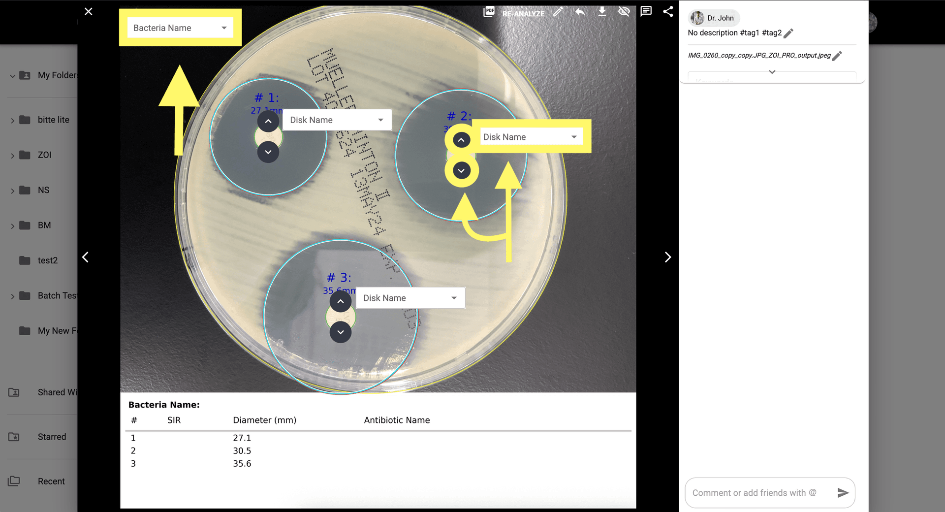 Step 7 image about Cara menggunakan ZOI Pro tutorial Step 7: Sesuaikan area ZOI secara manual dan atur Nama Bakteri atau Cakram/Antibiotik untuk perhitungan SIR.