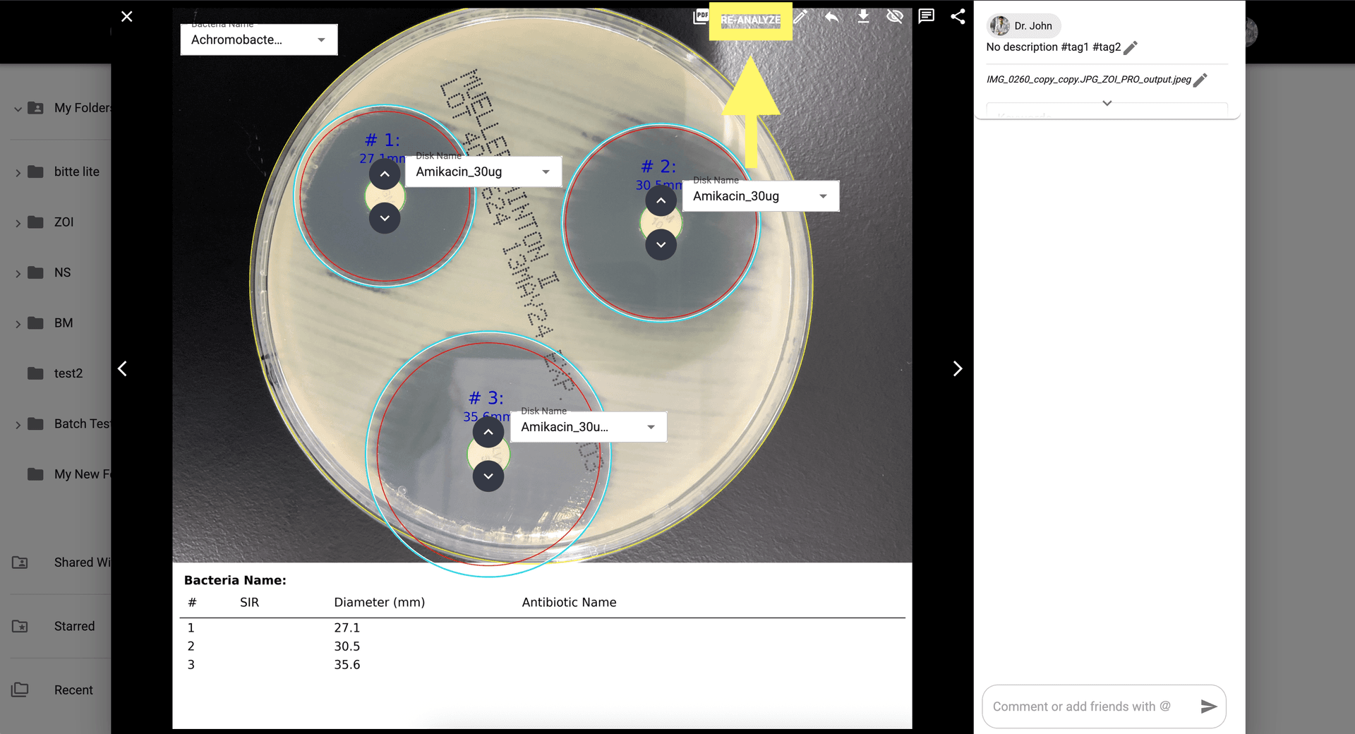 Step 8 image about Cara menggunakan ZOI Pro tutorial Step 8: Klik 'Analisis Ulang' setelah Anda puas dengan koreksi manual.