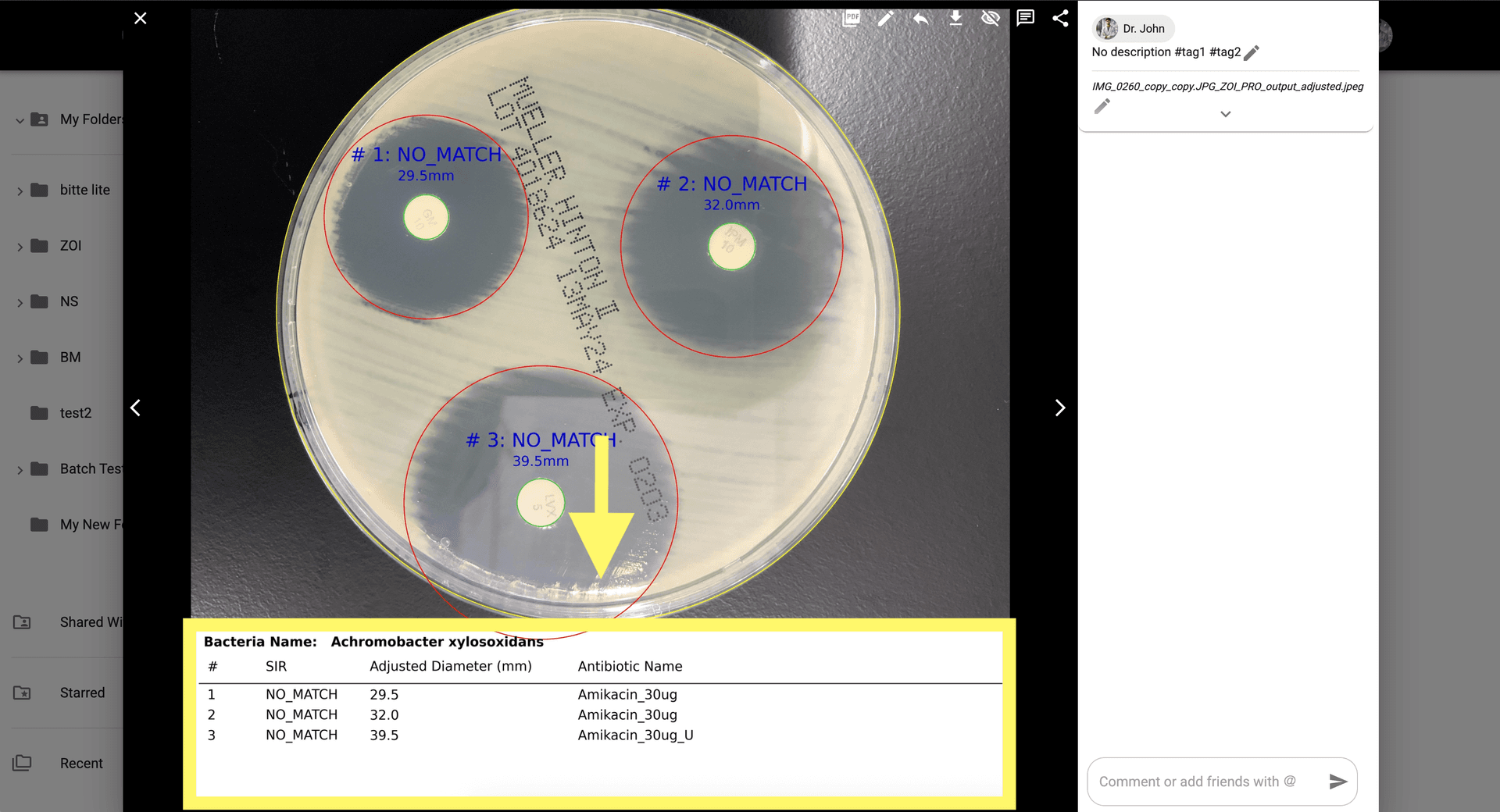 Step 9 image about Cara menggunakan ZOI Pro tutorial Step 9: Setelah dianalisis ulang, tinjau SIR, Diameter yang Disesuaikan, dan Nama Antibiotik di bagian bawah modal.