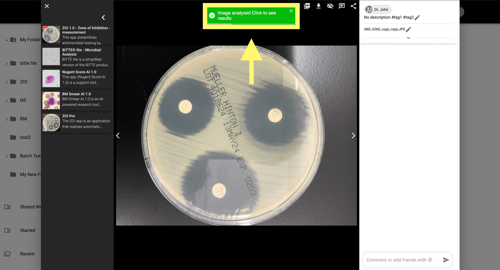 Step 5 image about Cara menggunakan ZOI Pro tutorial Step 5: Periksa hasil analisis di modal gambar atau buka gambar yang dihasilkan di galeri.