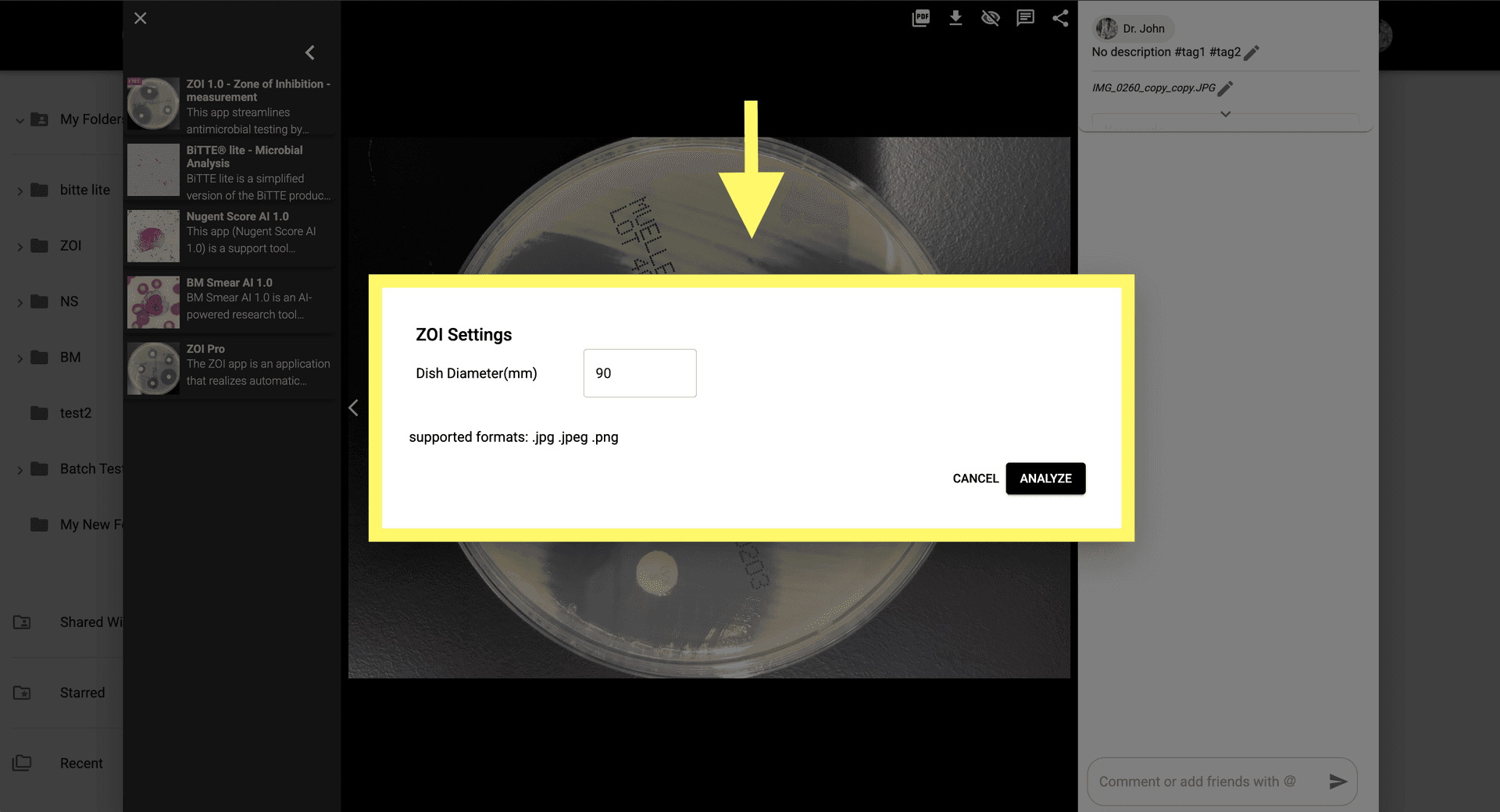 Step 3 image about Cara menggunakan ZOI Pro tutorial Step 3: Masukkan parameter untuk deteksi cakram antibiotik, pengukuran ukuran zona, dan lainnya.